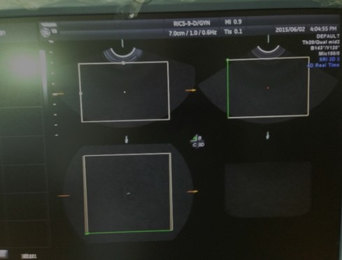 Error Reporting And Repair Of GE RIC5-9-D Motor