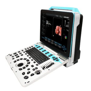 DW- P50 COLOR DOPPLER ULTRASOUND, DW-P50 color doppler ultrasound,