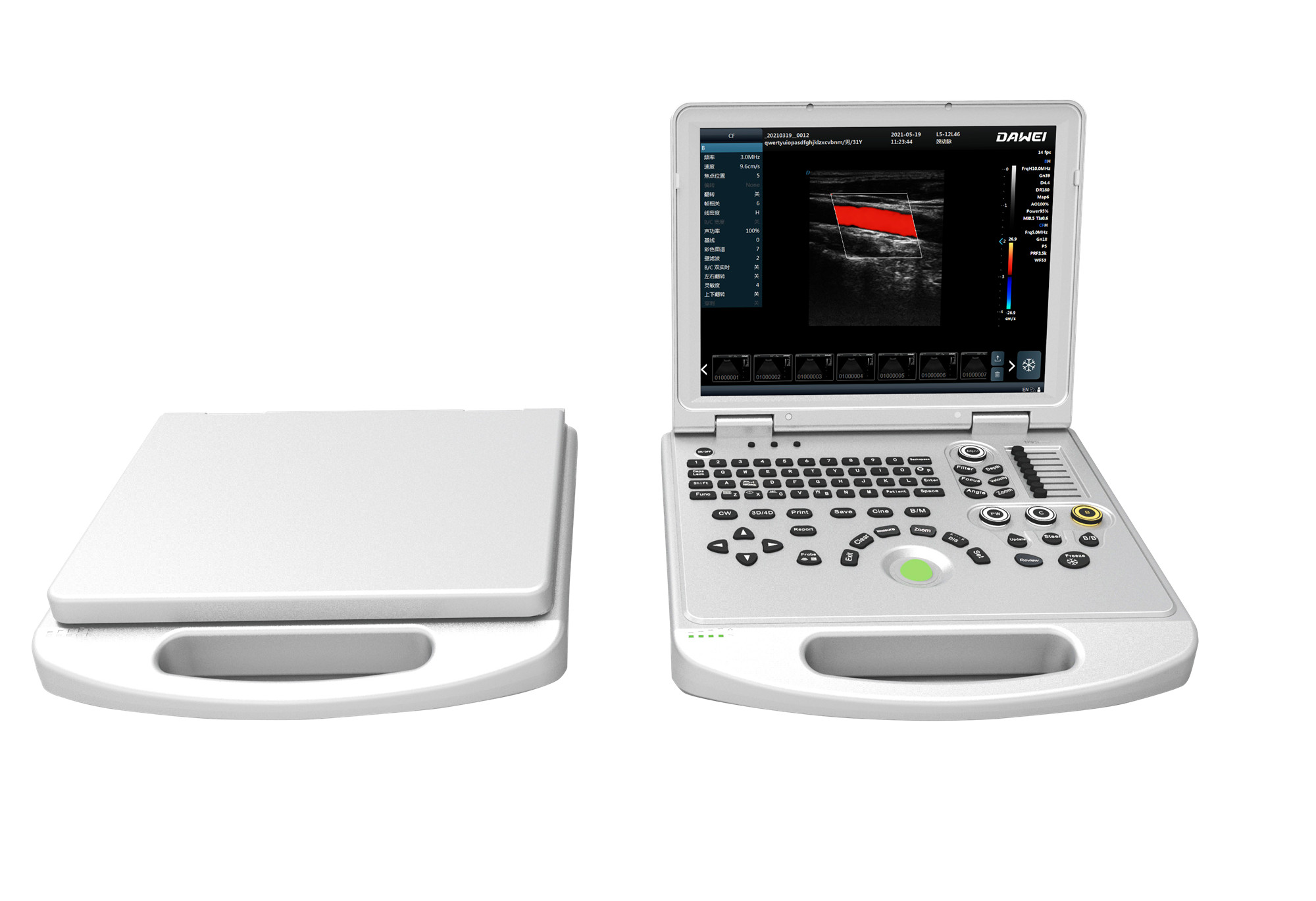 DW-L3 COLOR DOPPLER ULTRASOUND, DW‑L3 color doppler ultrasound scanner,